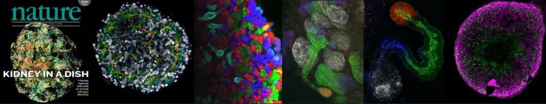 研究人员对人体的微型肾脏进行生物3D打印