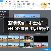 国际标准“本土化”,开启心血管健康精细化管理新篇章(图4) 国际标准“本土化”,开启心血管健康精细化管理新篇章(图4)
