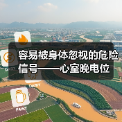 容易被身体忽视的危险信号——心室晚电位(图1) 容易被身体忽视的危险信号——心室晚电位(图1)