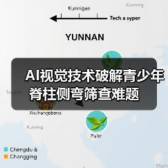 AI视觉技术破解青少年脊柱侧弯筛查难题(图1) AI视觉技术破解青少年脊柱侧弯筛查难题(图1)